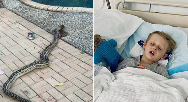 4-Year-Old Boy ᴀᴛᴛᴀᴄᴋᴇᴅ By 15-Foot Python Which ʙɪᴛ His Leg And Tried To Drag Him From His House Twice